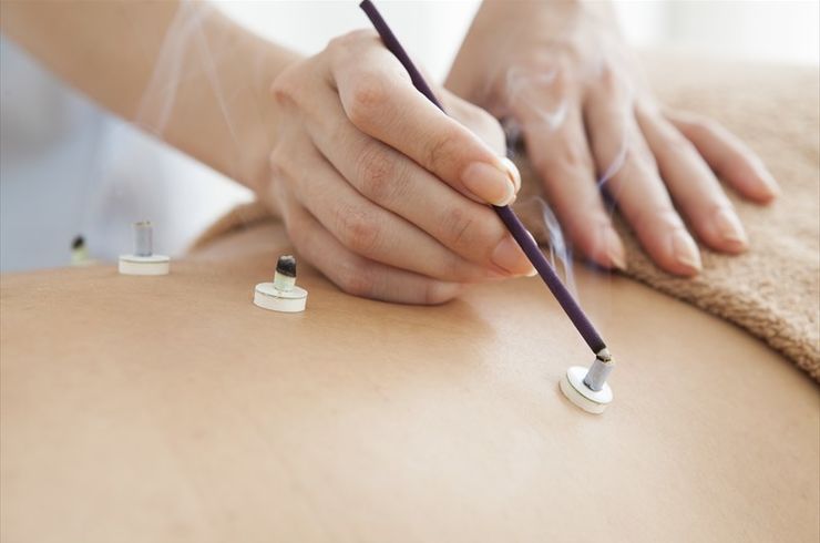 背中のお灸